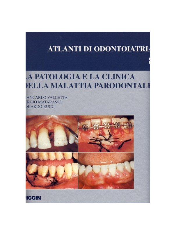 La patologia e la clinica della malattia parodontale