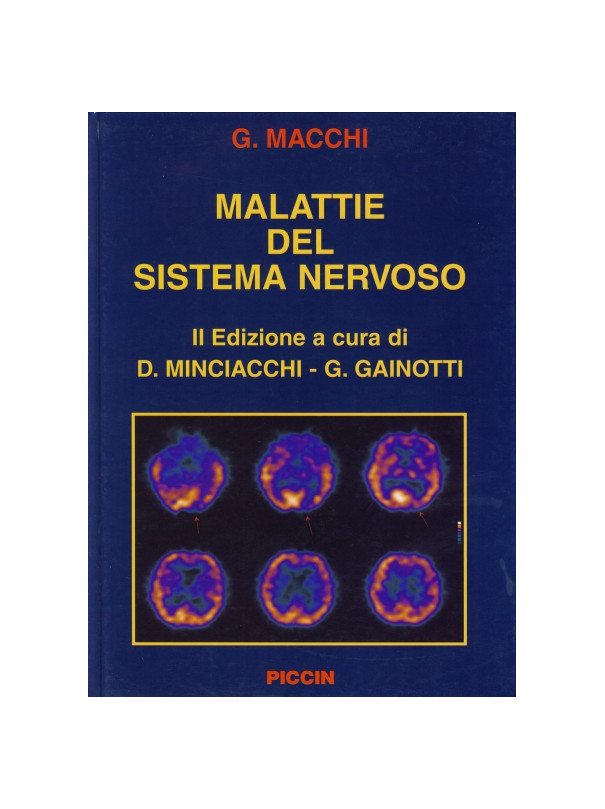 Malattie del Sistema Nervoso