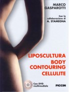 Liposcultura Body contouring Cellulite