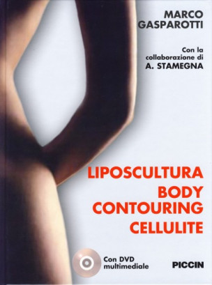 Liposcultura Body contouring Cellulite