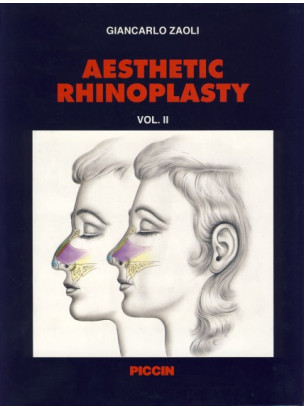 Aesthetic Rhinoplasty