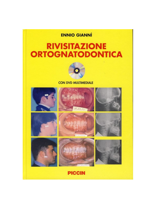 Rivisitazione Ortognatodontica