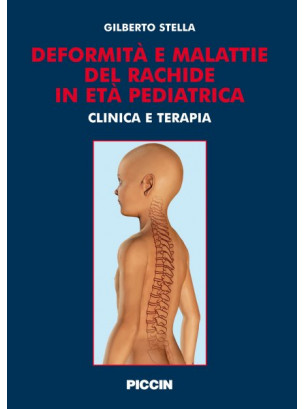 Deformità e malattie del rachide in età pediatrica