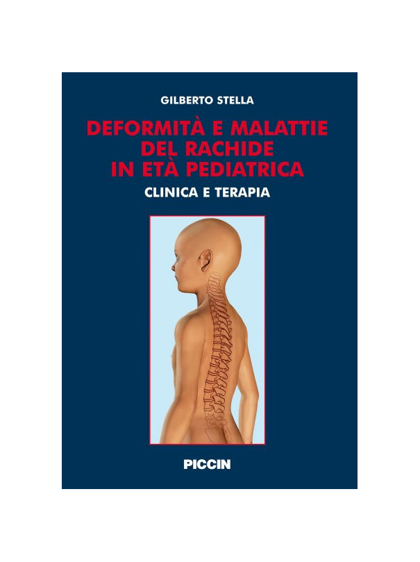 Deformità e malattie del rachide in età pediatrica