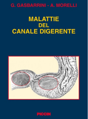 Malattie del canale digerente