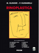 Rinoplastica