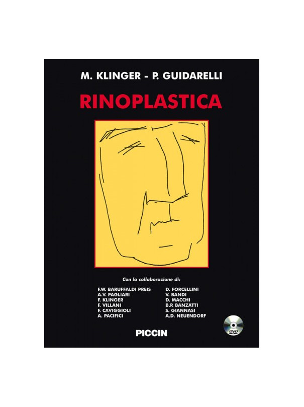 Rinoplastica