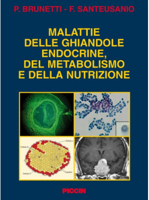 Malattie delle ghiandole endocrine, del metabolismo e della nutrizione