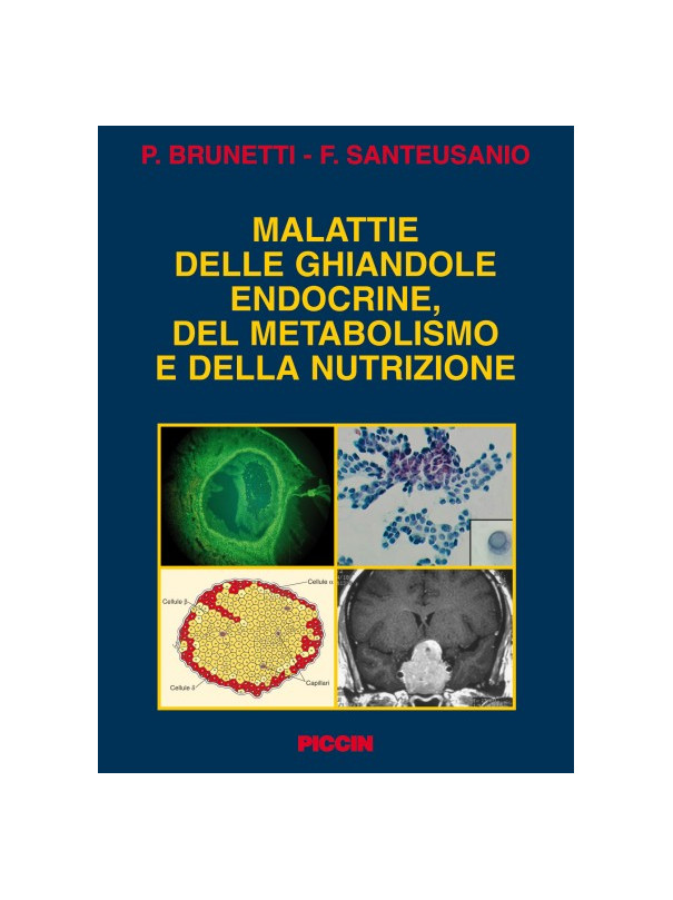 Malattie delle ghiandole endocrine, del metabolismo e della nutrizione