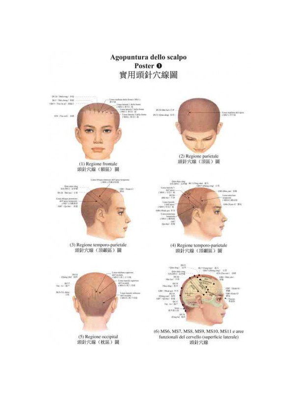 Poster di agopuntura dello scalpo