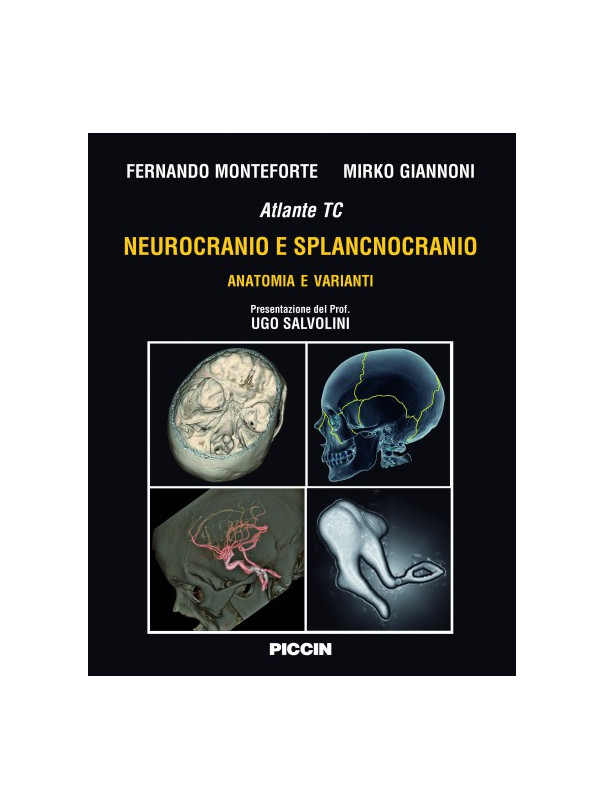 Atlante tc Neurocranio e Splancnocranio