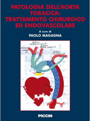 Patologia dell'aorta toracica: trattamento chirurgico ed endovascolare