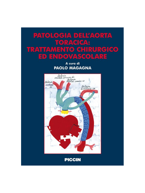 Patologia dell'aorta toracica: trattamento chirurgico ed endovascolare