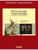 Ultrasonografia vascolare