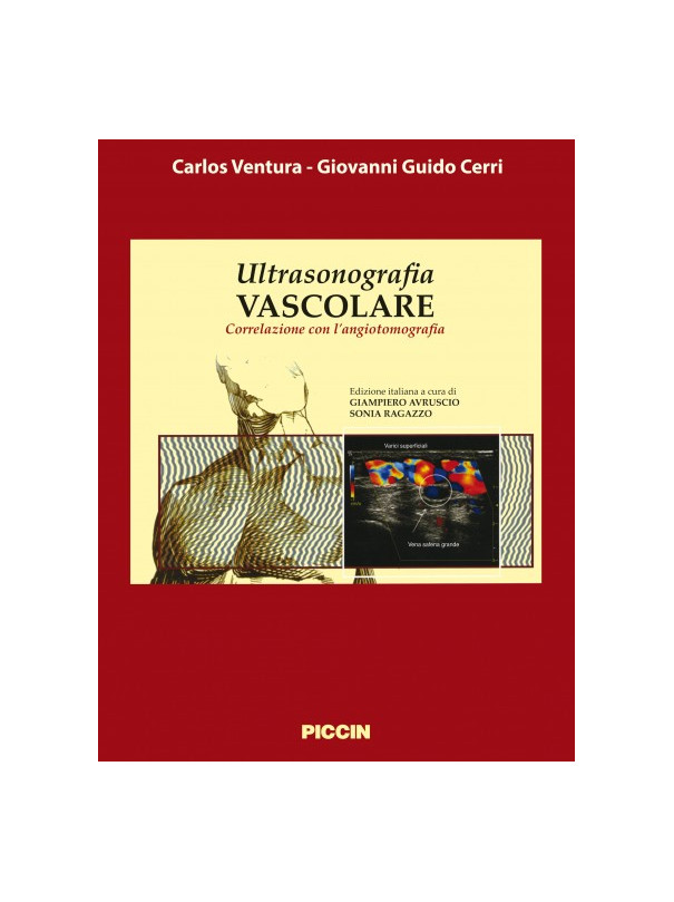 Ultrasonografia vascolare