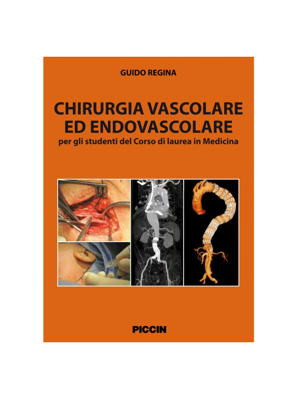 Chirurgia vascolare ed endovascolare