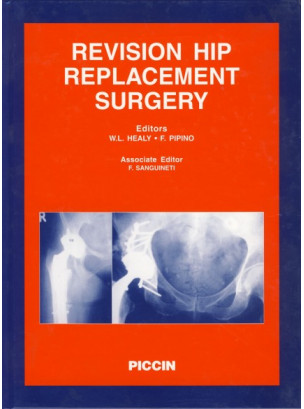 REVISION HIP REPLACEMENT SURGERY