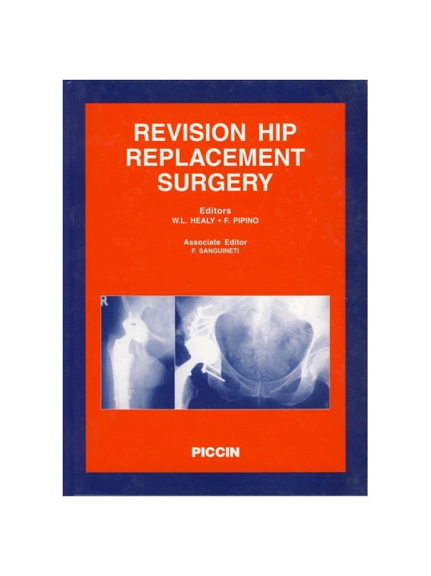 REVISION HIP REPLACEMENT SURGERY