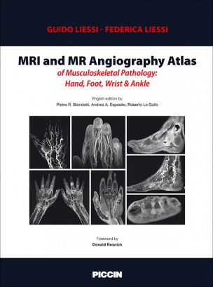 MRI and MR Angiography Atlas of Musculoskeletal Pathology: Hand, Foot, Wrist & Ankle