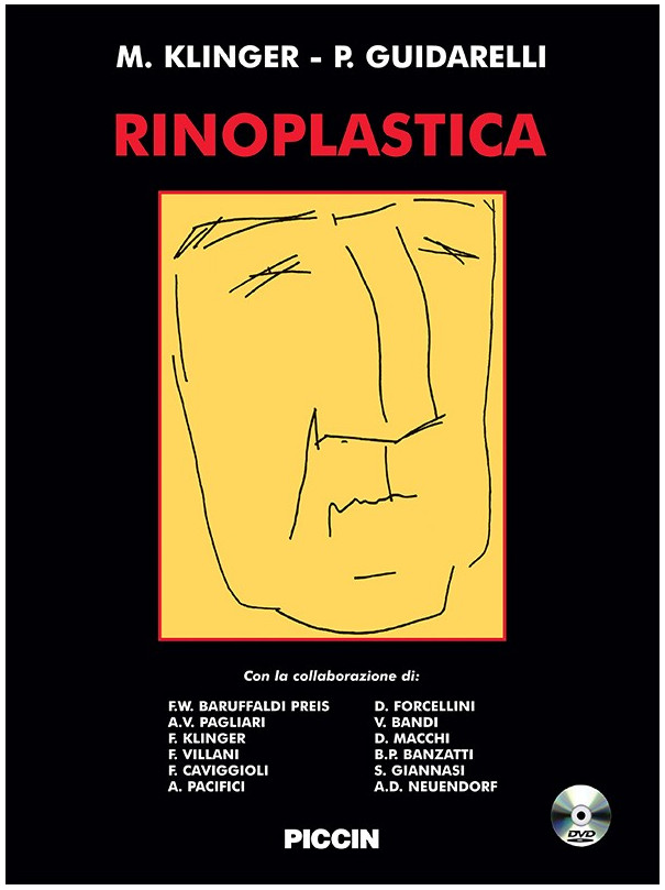 Rinoplastica