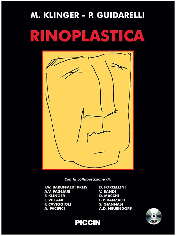 Rinoplastica