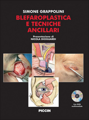 Blefaroplastica e Tecniche Ancillari + DVD