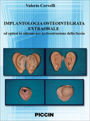 Implantologia Osteointegrata Extraorale ed epitesi in silicone per la ricostruzione della faccia - DVD