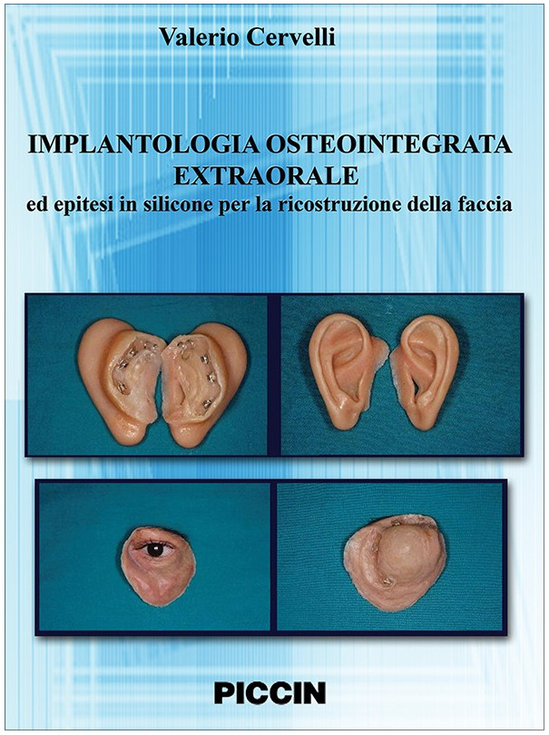 Implantologia Osteointegrata Extraorale ed epitesi in silicone per la ricostruzione della faccia - DVD