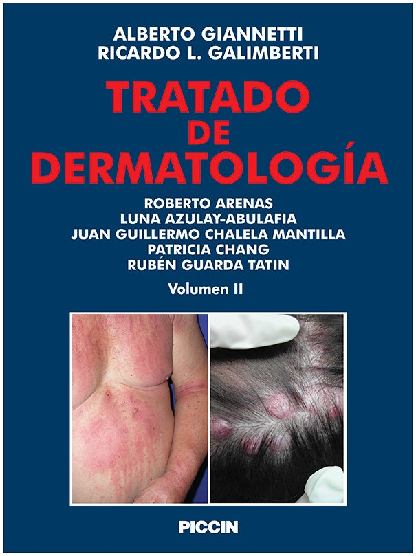 Tratado de dermatologìa