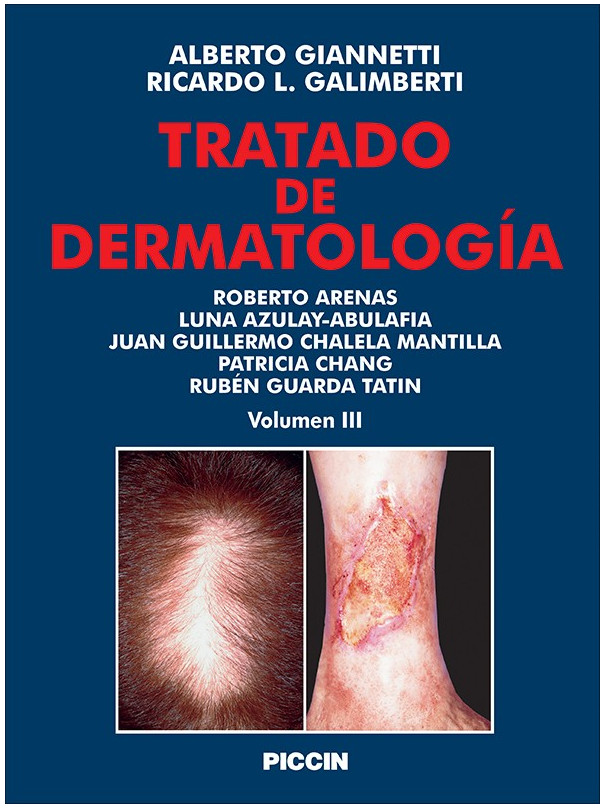 Tratado de dermatologìa