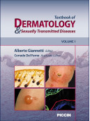 Textbook of dermatology and sexually transmitted diseases