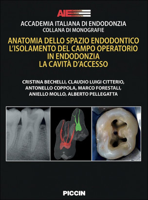 Anatomia dello spazio endodontico. L'isolamento del campo operatorio in endodonzia. la cavità d'accesso