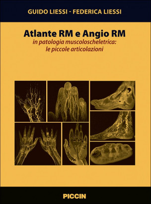 Atlante Rm e Angio Rm in patologia muscoloscheletrica: le piccole articolazioni