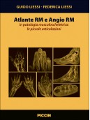 Atlante Rm e Angio Rm in patologia muscoloscheletrica: le piccole articolazioni
