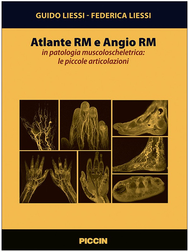 Atlante Rm e Angio Rm in patologia muscoloscheletrica: le piccole articolazioni