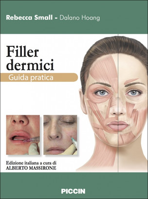 I filler - Guida pratica