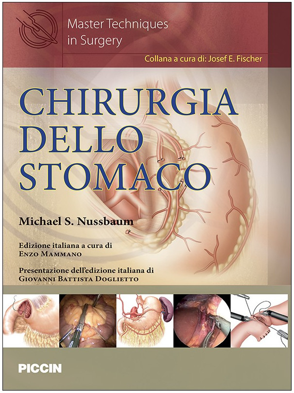 Chirurgia dello stomaco