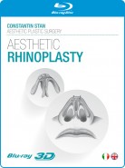 Aesthetic Rhinoplasty