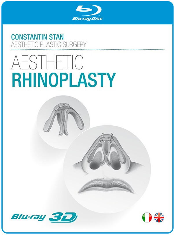 Aesthetic Rhinoplasty