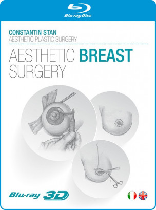 Aesthetic Breast Surgery