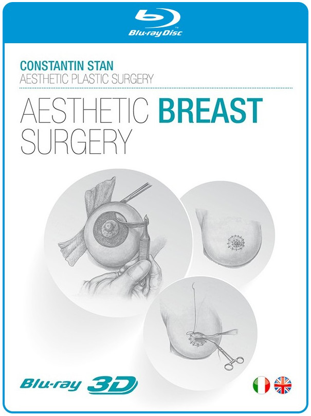 Aesthetic Breast Surgery