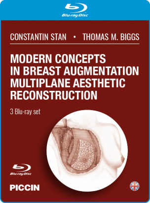 Modern concepts in breast augmentation multiplane aesthetic reconstruction