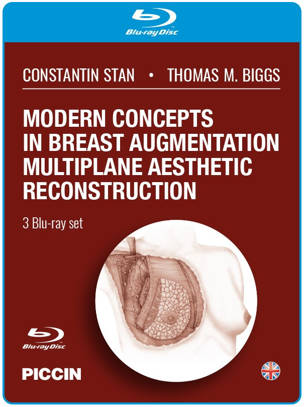 Modern concepts in breast augmentation multiplane aesthetic reconstruction