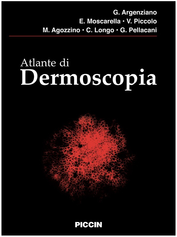 Atlante di Dermoscopia