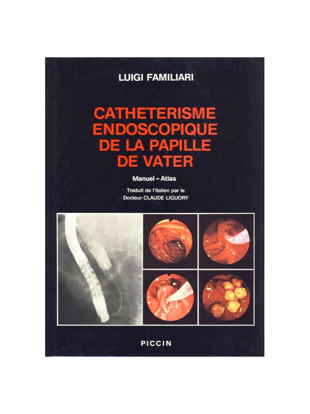 CATHETERISME ENDOSCOPIQUE DE LA PAPILLE DE VATER