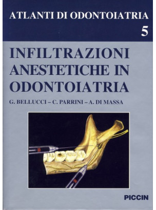 Infiltrazioni Anestetiche in Odontoiatria - Vol. 5
