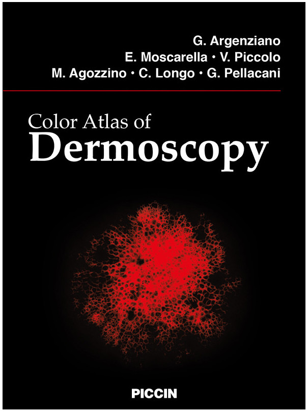 Color Atlas of Dermoscopy