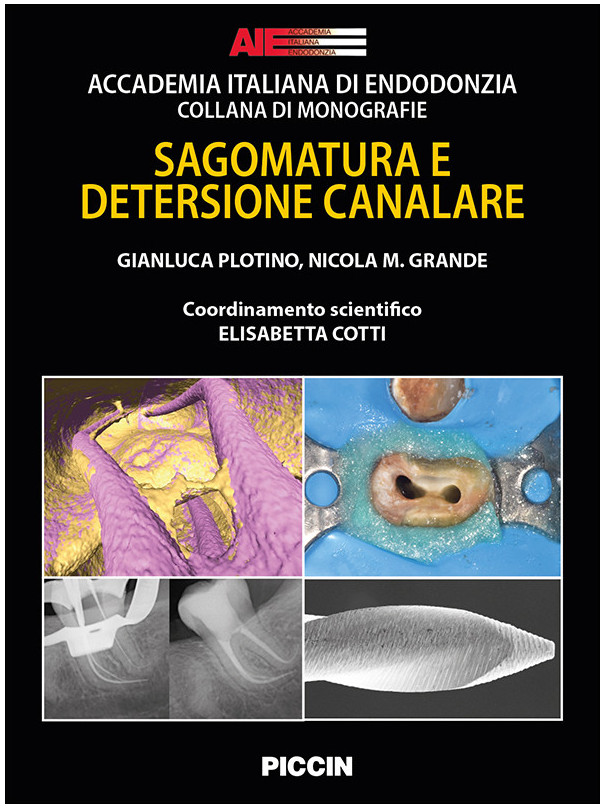 SAGOMATURA E DETERSIONE CANALARE