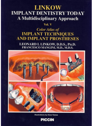COLOR ATLAS OF IMPLANT TECHNIQUES AND IMPLANT PROSTHESES