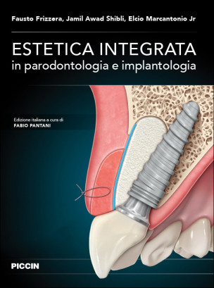 Estetica integrata in parodontologia e implantologia